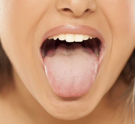 witte tong door stress oorzaken