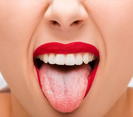 witte tong door stress symptomen